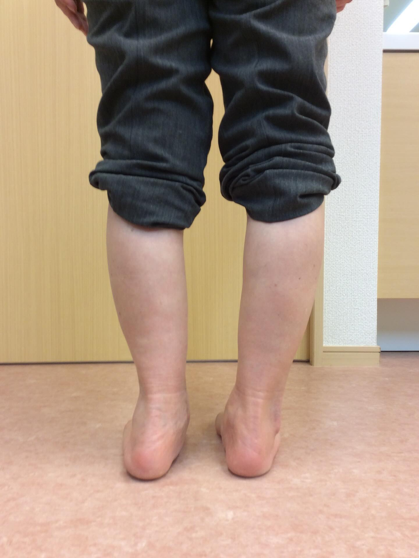 長年、腰痛や膝の痛み、股関節の痛みを患っている方の多くには、...