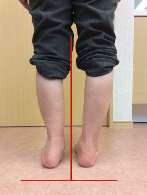 長年、腰痛や膝の痛み、股関節の痛みを患っている方の多くには、...